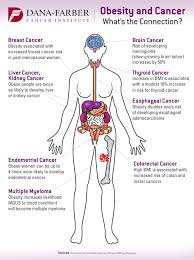 Cancer is a leading cause of death worldwide, accounting for nearly 10 million deaths in 2020 (1). Can Obesity Cause Cancer