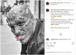 Ce matin, c'est plutôt en direction d'un homme en survêtement adidas qui évite de se faire renverser par une doge et cela avec classe ! Appele Black Alien Un Homme Se Fait Retirer Les Oreilles Et Le Nez