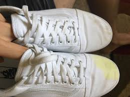 See full list on wikihow.com Parity How Do You Get A Stain Out Of White Vans Up To 73 Off