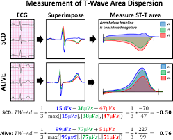 Image result for T Wave