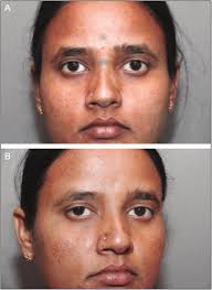 Image result for forehead tattoo