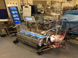 Where the fabric is passed over some free roller & guider. Cardiopulmonary Bypass Anaesthesia Intensive Care Medicine