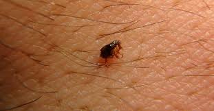 Image result for what do lice look like in dog fur