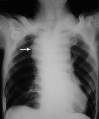نتیجه جستجوی لغت [widened] در گوگل