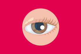 Mata kuning juga boleh disebabkan oleh pankreatitis, jika ini berlaku maka hospital diperlukan di hospital. Ada Bercak Kuning Di Sudut Mata Bisa Jadi Xanthelasma