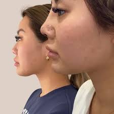 DR. KENNETH KIM PLASTIC SURGERY