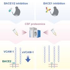 Image result for CSF PCR