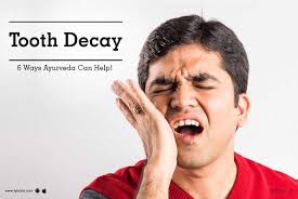 Maybe you would like to learn more about one of these? Tooth Decay 6 Ways Ayurveda Can Help By Dr Gokulan Bg Lybrate