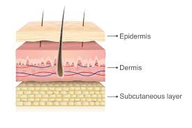 Image result for Skin Tear