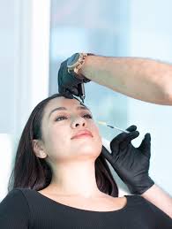 Los Angeles Stretch Mark Removal