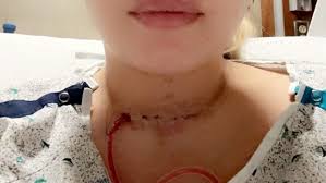 Fundraiser for Jadelyne Skelton by Madison Anderson : Support Jadelyne  Smith's Fight Against Cancer