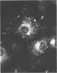 Symptoms start about 2 to 5 days after contact with the virus. A Monolayer Of Wi 38 Cells Showing Rs Virus Induced Syncytial Plaques Download Scientific Diagram