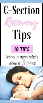 C Section Recovery Tips C Section Recovery