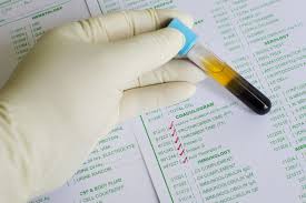 Ptt (partial thromboplastin time) is a measure used to determine the blood coagulation time to ptt test reveals the integrity of intrinsic pathway and common coagulation factors involved in blood. Activated Partial Thromboplastin Time Aptt Test Definitions Normal Ranges Healthmatters Io Lab Results Explained