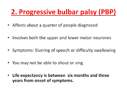 Image result for Progressive Bulbar Paralysis