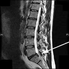 Neurochirurgischen Praxis Und Klinik In Schwabisch Hall Praxis Neurochirurgie Schwabisch Hall