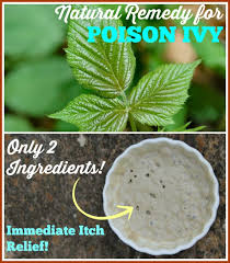 Natural Remedy For Poison Ivy Immediate Itch Relief Works On Bites Stings Rashes Too Recipe Poison Ivy Remedies Natural Remedies Natural Healing Remedies