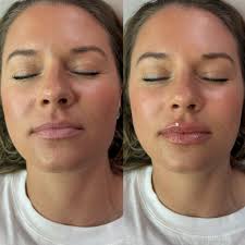 The Beauty Lounge Med Spa