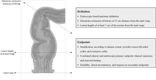 Image result for Proctitis