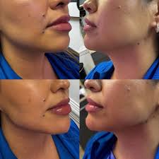 Carrie Ramos BSN RN Aesthetic Injector (@goddess_injector) • Instagram  photos and videos