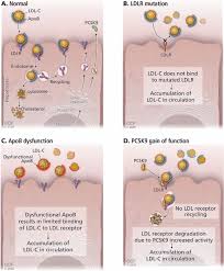 Image result for Hypercholesterolemia