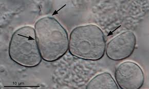 Image result for Micrargeriella