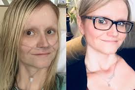 Fundraiser for Laura Jackett by Kristi Kearn : All They Want for Christmas  are Two Little Feet