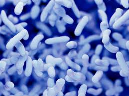 Legionella pneumophila is a gram negative, strictly aerobic bacterium of the. Legionella Pneumophila Antigen The Native Antigen Company
