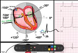 Image result for PR Interval