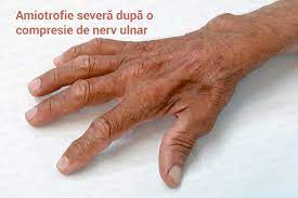 We did not find results for: Furnicaturi Si Amorteli In Maini Si Degete Tratament Dr Vladislav Gyebnar