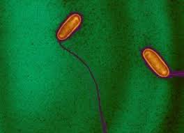 Elle entraine une infection pulmonaire aigüe. Legionellosis Unique Host Cell Reprogramming Induced By The Bacterial Pathogen Legionella Pneumophila Institut Pasteur