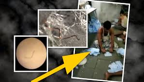 Here you'll find answers to common questions about morgellons morgellons disease is an uncommon, poorly understood condition. Vcn45fusnupkwm