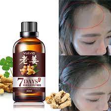 It is rich in vitamin a, e and antioxidants. 7 Days Ginger Hair Growth Essential Oils Hair Care Essence Beard Growth Dry Hair Lost Products 30ml Beard Oil Essential Oils For Hair Hair Nutrition Essential Oil Hair Growth