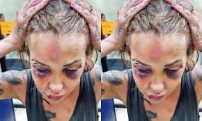 Justiça condena ex-namorado de jornalista por tentativa de feminicídio