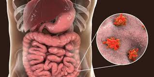 Julat tekanan darah yang normal adalah di antara bacaan 90/60 milimeter merkuri (mmhg) hingga ia boleh mempengaruhi pelbagai organ dalam badan termasuk jantung, buah pinggang dan bagi pesakit kehilangan darah perlu diganti dengan darah semula. Disentri Amoeba Bukan Sakit Perut Biasa Kenali Gejalanya