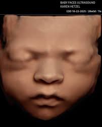 Look how sweet! Meet Mr Harrison Tate! Born at 39weeks 4days weighing 7lbs  8.8oz! Thank you Dakota for sharing him with us! Ultrasounds done at  23weeks & 32weeks #babyfacesultrasound #4dultrasound #comparison #crowleyla  #