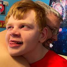 Shaken Baby Syndrome: Austin's story