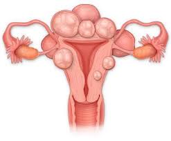 If your period has come on twice this month, make sure you've taken your birth control correctly. Why You Might Have Two Periods In A Month And When You Need To See Your Gp