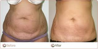 Pin On Plastic Surgery