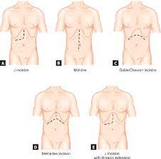 Check spelling or type a new query. Jaypeedigital Ebook Reader