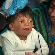 Since 2008, my vision has been to establish a Comprehensive Cleft Center in  Guatemala, and over the past 17 years, we have made that a reality.  However, one crucial aspect was still