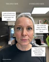 Baylee Miller (@skin.by.baylee) • Instagram photos and videos