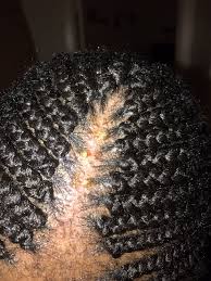 However, all of that tension isn't good for your scalp. 4c Hair Behaviors Not Challenges Black Daring