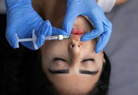 Image result for Dermal Filler Injection