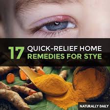 19 Quick Relief Home Remedies For Stye Red Swollen Eye Eyelid Home Remedies For Skin Natural Skin Care Remedies Eye Care Health