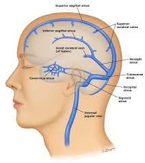 36. Loss of stapedial reflex indicates all of the following except: A.  Severe sensorineural hearing loss. B. Profound sensorineural hearing loss.  C. Mild sensorineural hearing loss. D. Facial nerve paralysis. E. Conductive