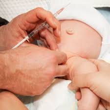 Image result for Neonatal Circumcision