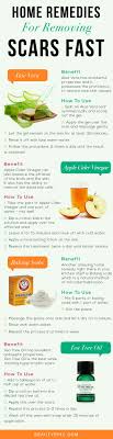 Pin On Home Remedies
