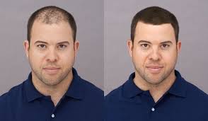 6 best hair fibers reviewed. How Long Do Hair Fibers Last On Hair Toppik Blog