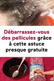 Debarrassez Vous Des Pellicules Grace A Cette Astuce Presque Gratuite Traitements Capillaires Maison Pellicule Cheveux Anti Pellicule Naturel